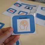 Atelier de l'ETP AVC